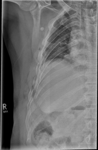 Rippenserie re1 Rippenserie re1